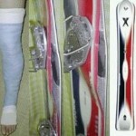 my leg and rossignol